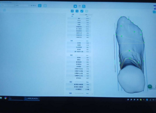 全国5家工作室都可以开始3D足部检测和鞋垫定制 侧弯支具相关文章 第3张