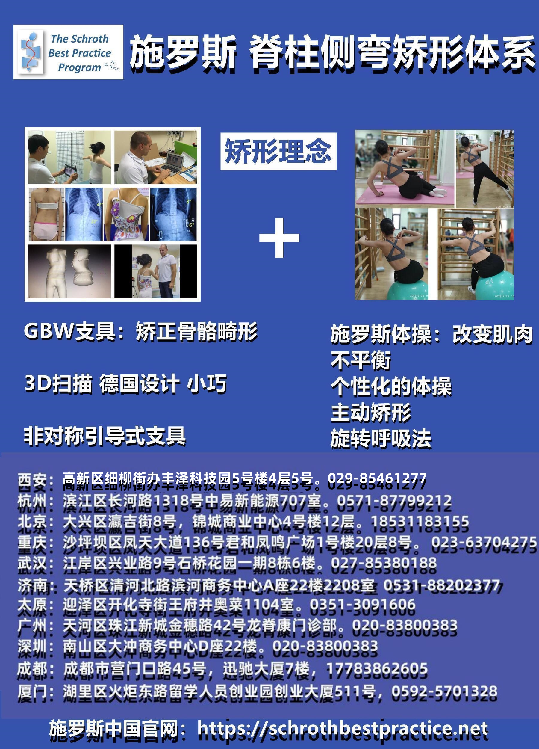 GBW支具案例20240823-胸弯52°的短期改善 GBW脊柱侧弯支具矫正案例 第3张